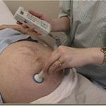 Ultrasound Gel OneMed