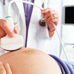 Ultrasound Gel OneMed